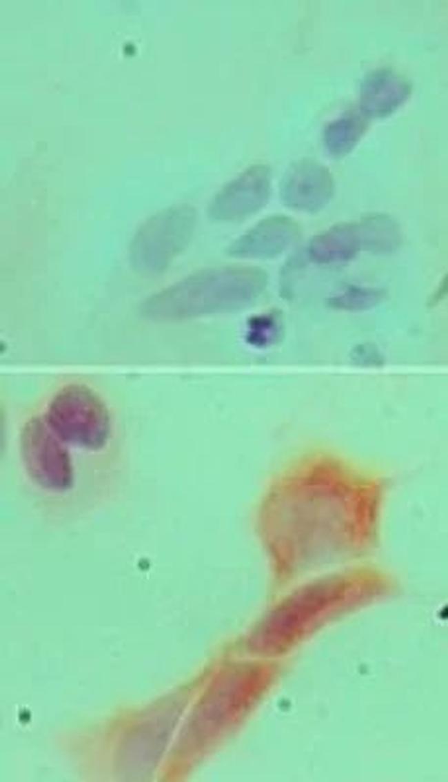 MyD88 Antibody in Immunocytochemistry (ICC/IF)