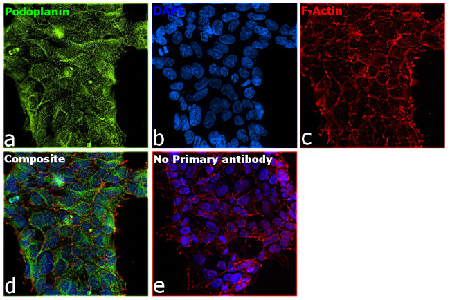 Podoplanin Antibody in Immunocytochemistry (ICC/IF)