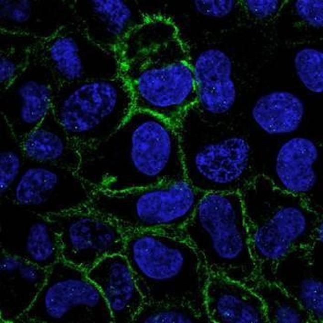 Carbonic Anhydrase IX Antibody in Immunocytochemistry (ICC/IF)