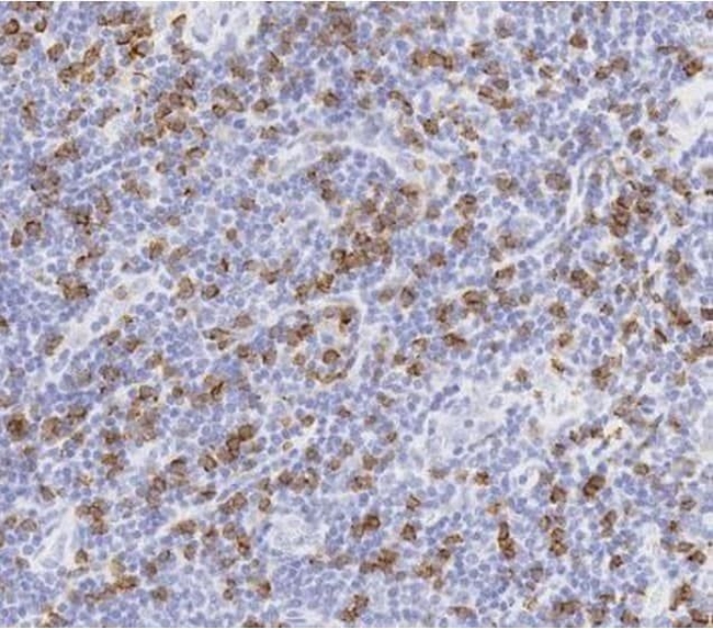 CD8 Antibody in Immunohistochemistry (Paraffin) (IHC (P))