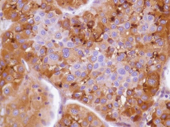 Glypican 3 Antibody in Immunohistochemistry (Paraffin) (IHC (P))