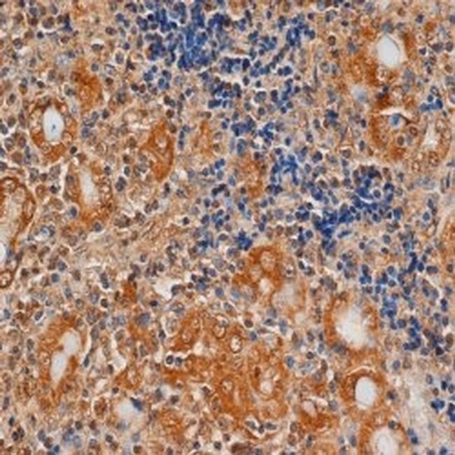 TSH Receptor Antibody in Immunohistochemistry (Paraffin) (IHC (P))