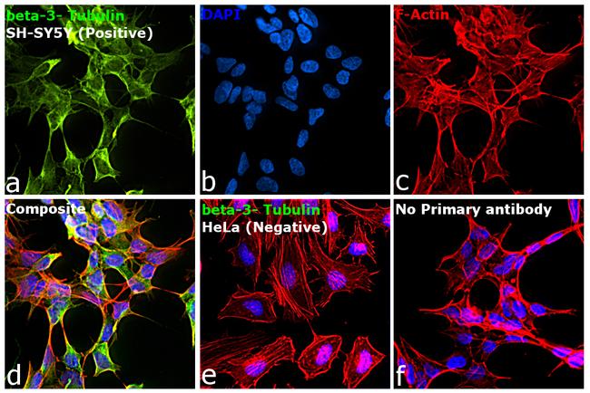 Mouse IgG2a (Heavy chain) Secondary Antibody in Immunocytochemistry (ICC/IF)