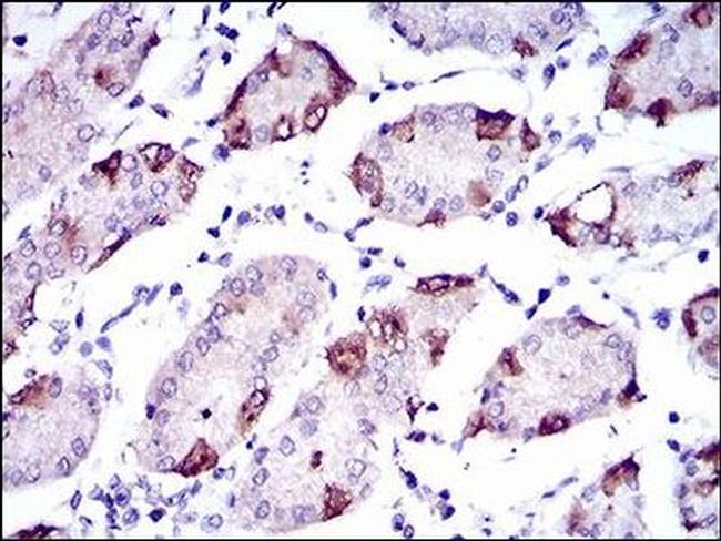 SLC27A5 Antibody in Immunohistochemistry (Paraffin) (IHC (P))