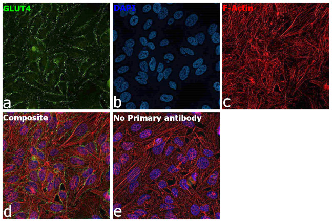 GLUT4 Antibody in Immunocytochemistry (ICC/IF)