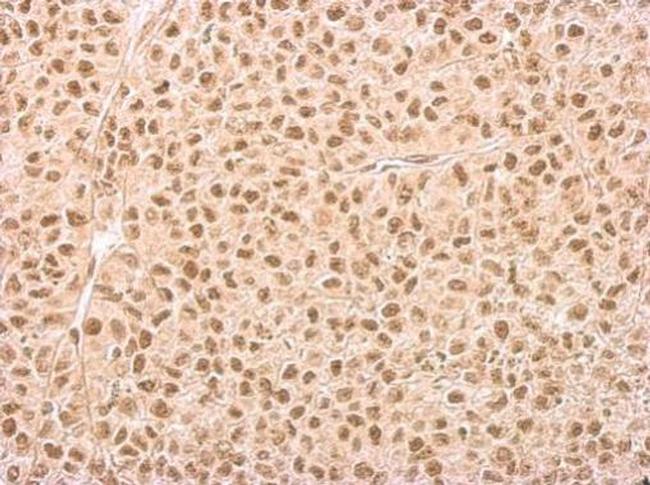 IP6K1 Antibody in Immunohistochemistry (Paraffin) (IHC (P))