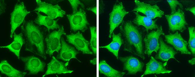 TAGLN Antibody in Immunocytochemistry (ICC/IF)