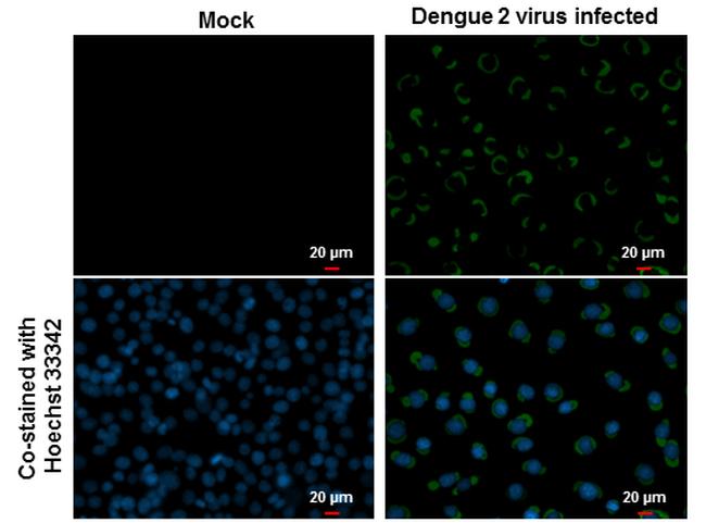 Dengue Virus Type 2 Envelope Antibody in Immunocytochemistry (ICC/IF)