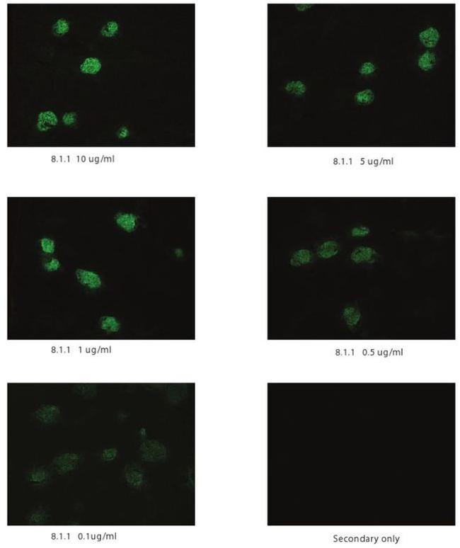 Podoplanin Antibody in Immunohistochemistry (Frozen) (IHC (F))