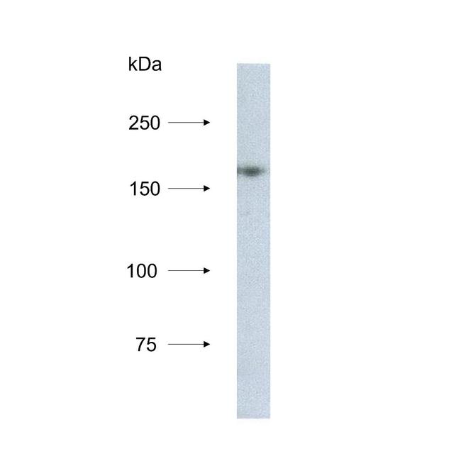 NCAPD3 Antibody in Western Blot (WB)