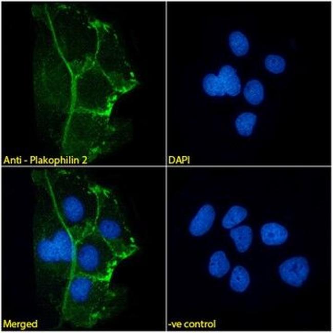 PKP2 Antibody in Immunocytochemistry (ICC/IF)