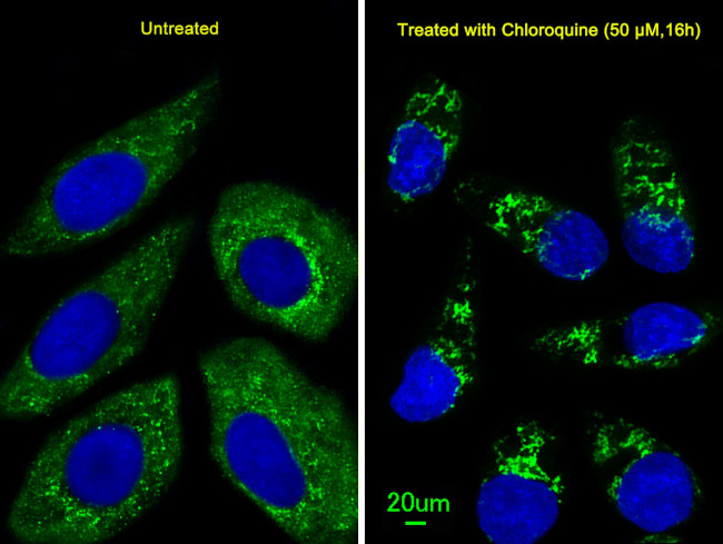 ATG4D Antibody in Immunocytochemistry (ICC/IF)