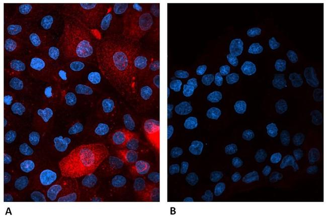 beta-2 Microglobulin Antibody in Immunocytochemistry (ICC/IF)