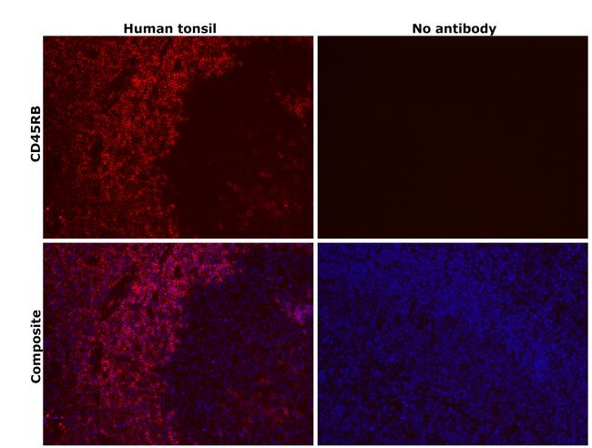 CD45RB Antibody in Immunohistochemistry (Paraffin) (IHC (P))