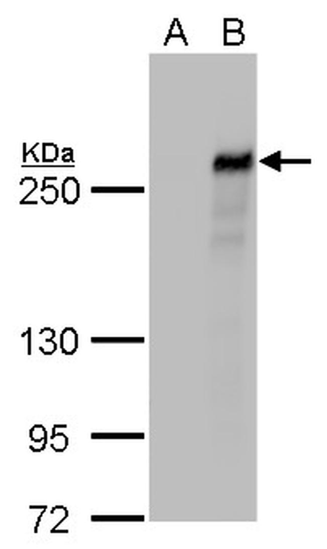 TET2 Antibody in Western Blot (WB)