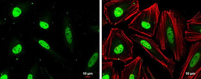 CAS Antibody in Immunocytochemistry (ICC/IF)