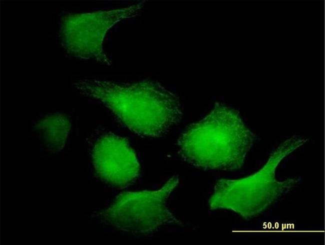 Adenylate Kinase 1 Antibody in Immunocytochemistry (ICC/IF)