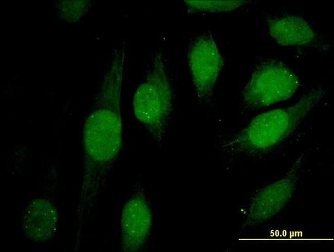 ATRX Antibody in Immunocytochemistry (ICC/IF)