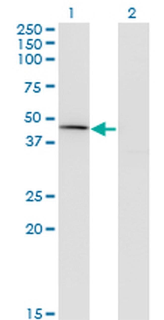 Carboxypeptidase A1 Antibody in Western Blot (WB)