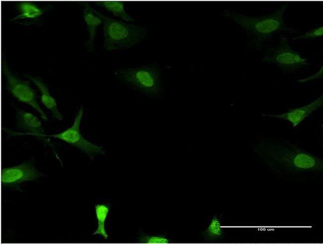 DCK Antibody in Immunocytochemistry (ICC/IF)