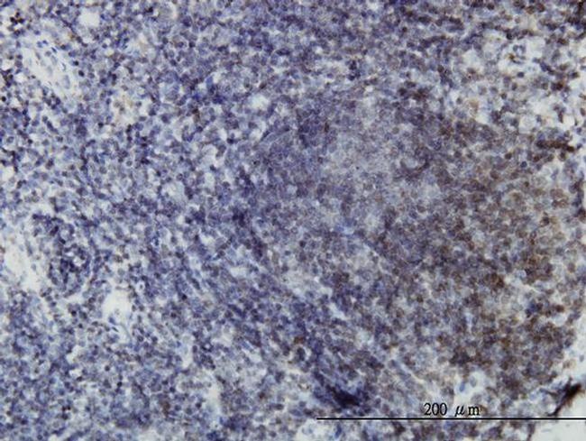 EphB3 Antibody in Immunohistochemistry (PFA fixed) (IHC (PFA))