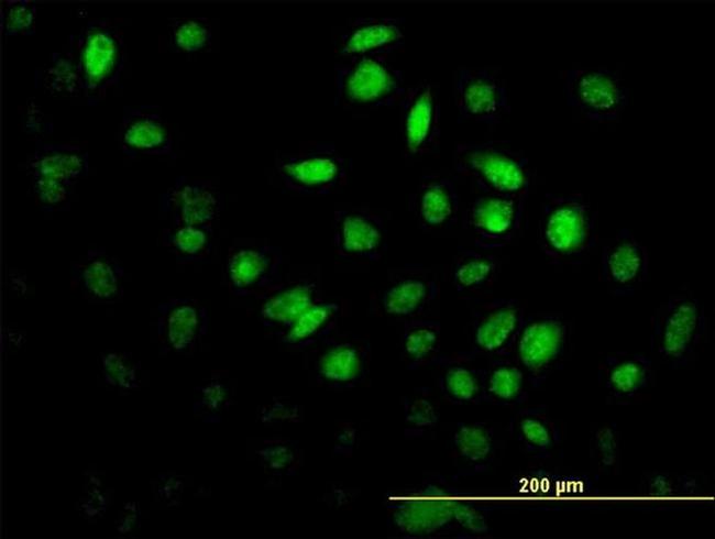 FOXF2 Antibody in Immunocytochemistry (ICC/IF)