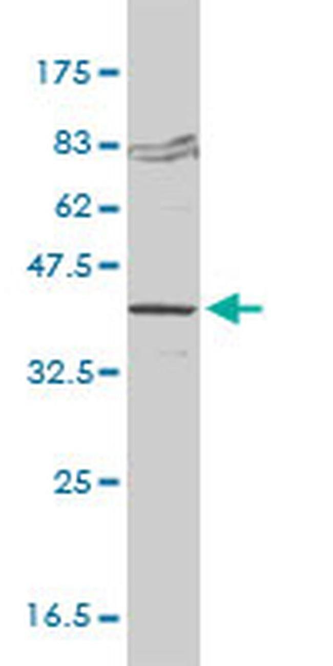 FVT1 Antibody in Western Blot (WB)