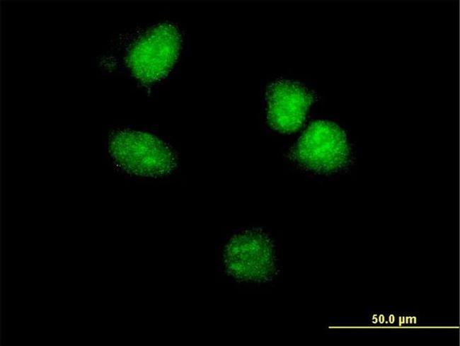 HOXA5 Antibody in Immunocytochemistry (ICC/IF)