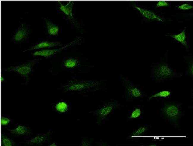 ID1 Antibody in Immunocytochemistry (ICC/IF)