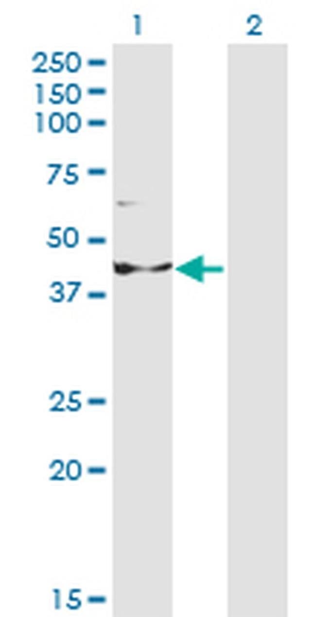 INPP1 Antibody in Western Blot (WB)