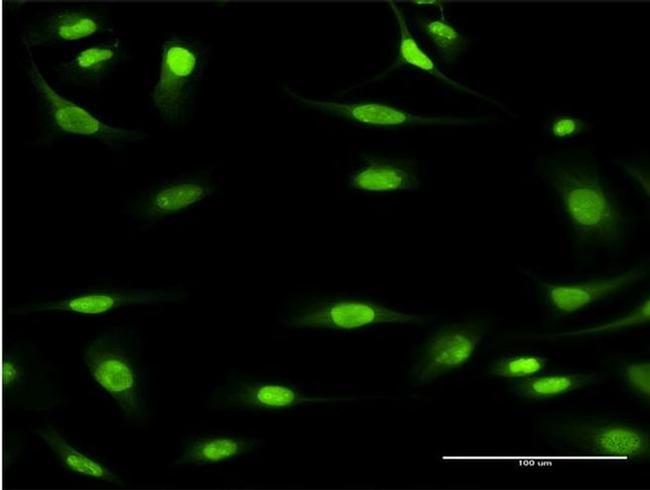 MCM3 Antibody in Immunocytochemistry (ICC/IF)