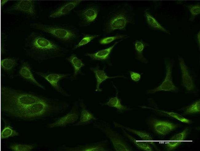 Ribophorin I Antibody in Immunocytochemistry (ICC/IF)