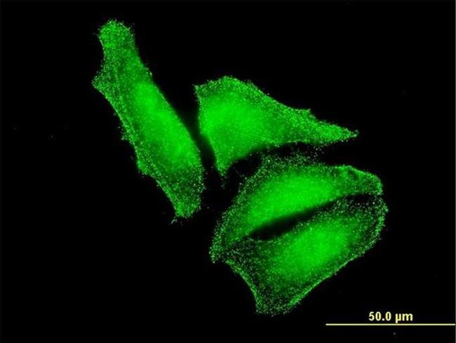 MST2 Antibody in Immunocytochemistry (ICC/IF)