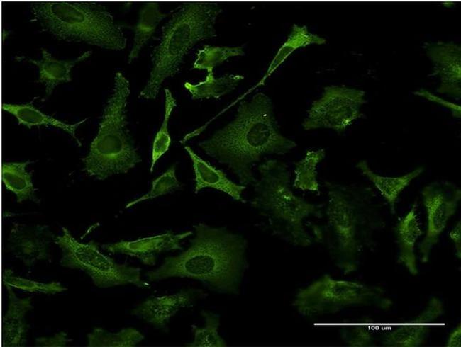 TAP1 Antibody in Immunocytochemistry (ICC/IF)