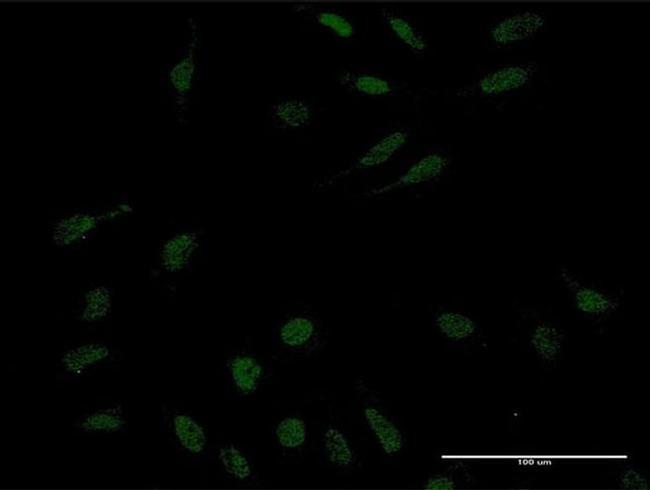 KLF10 Antibody in Immunocytochemistry (ICC/IF)