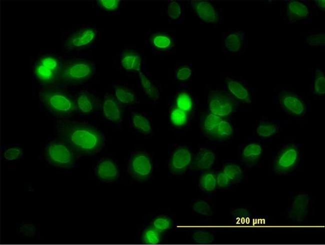 ZNF182 Antibody in Immunocytochemistry (ICC/IF)