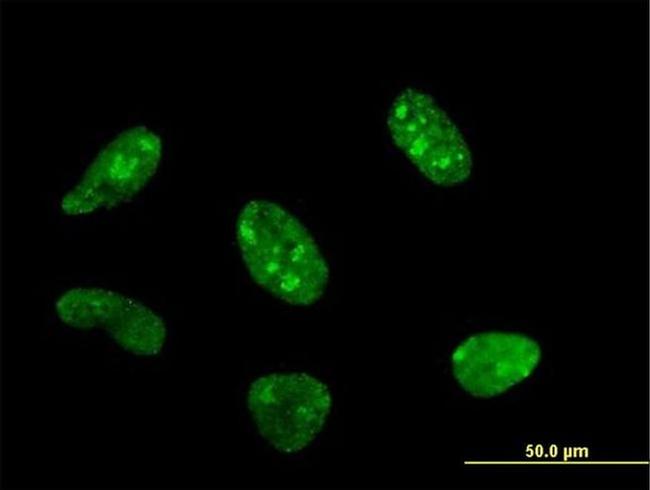 POLR1C Antibody in Immunocytochemistry (ICC/IF)