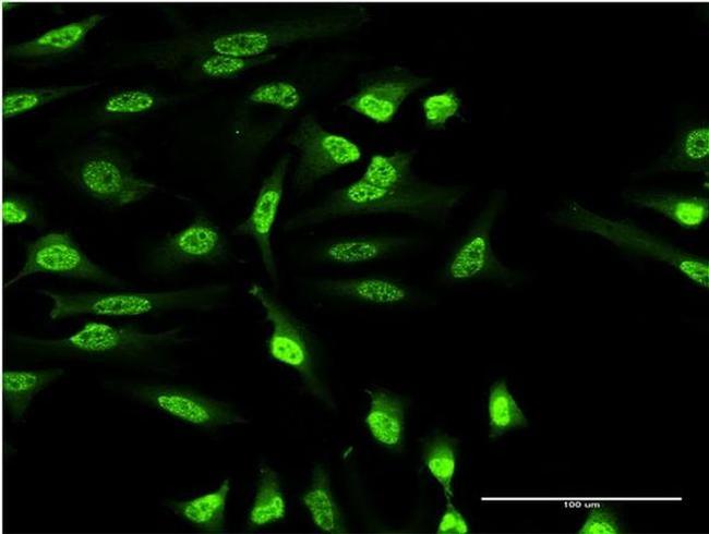 OXSR1 Antibody in Immunocytochemistry (ICC/IF)