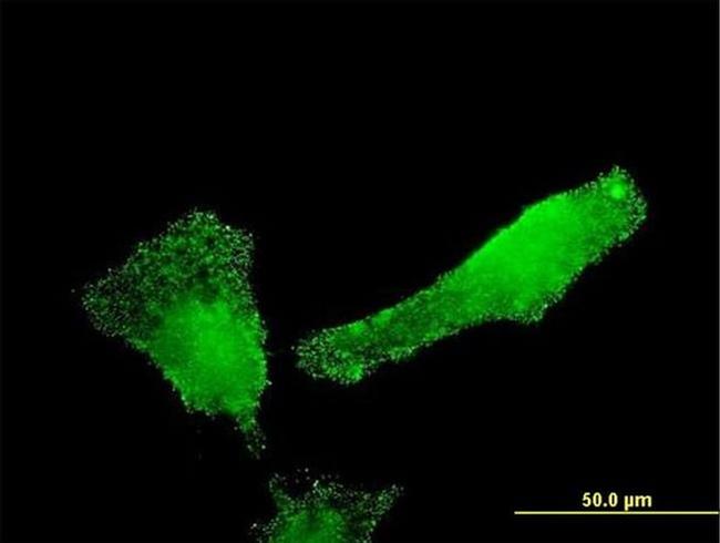 SH2D3C Antibody in Immunocytochemistry (ICC/IF)