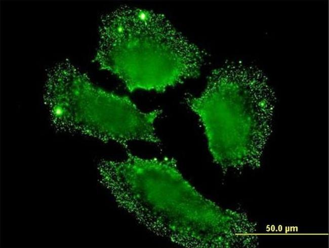 SH2D3C Antibody in Immunocytochemistry (ICC/IF)