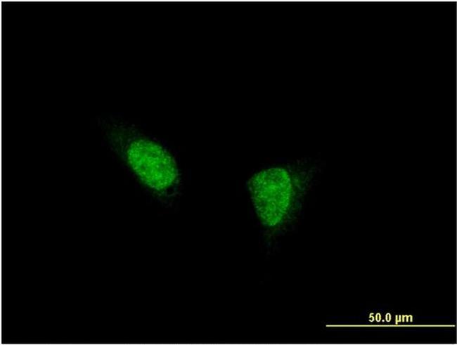 TSHZ1 Antibody in Immunocytochemistry (ICC/IF)