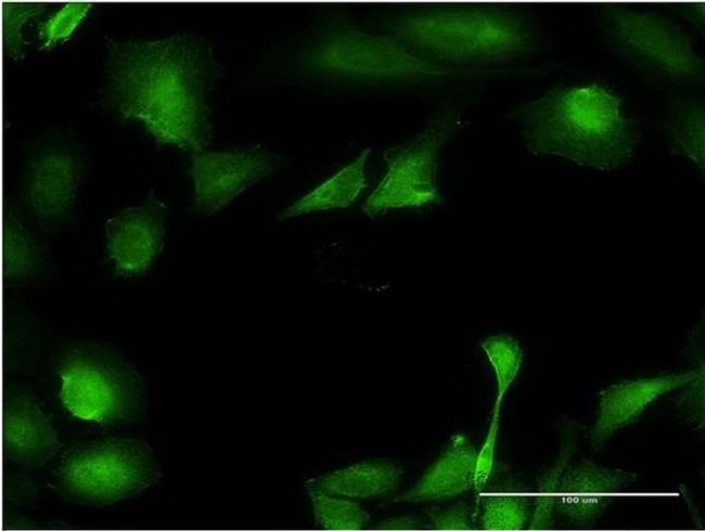 B3GNT3 Antibody in Immunocytochemistry (ICC/IF)