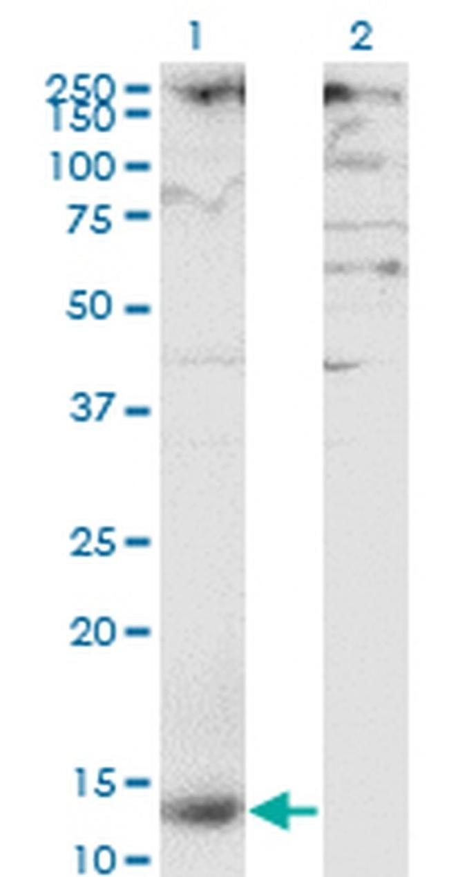 CD299 (DC-SIGN/L) Antibody in Western Blot (WB)