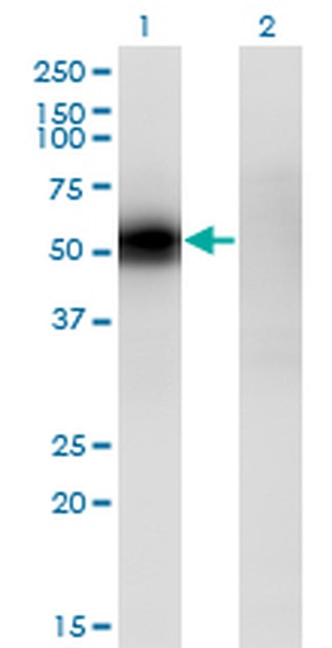 KLF12 Antibody in Western Blot (WB)