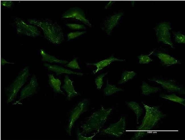 ABCB9 Antibody in Immunocytochemistry (ICC/IF)