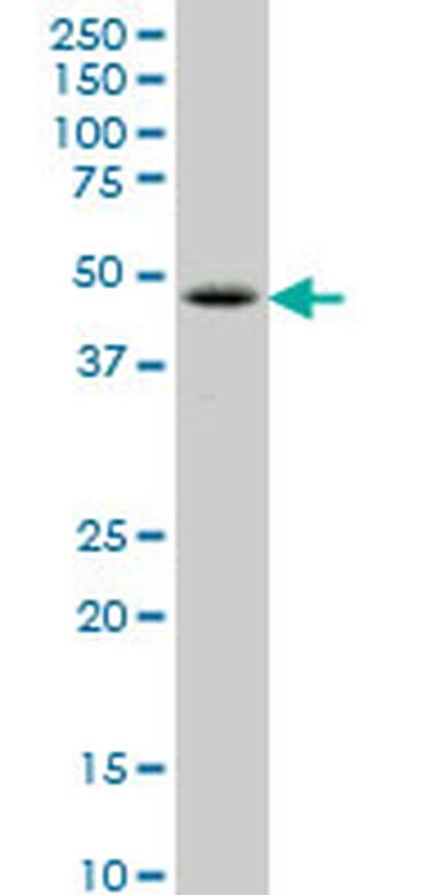 LHX6 Antibody in Western Blot (WB)