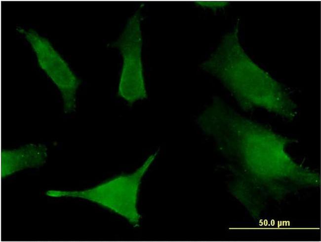 SLC6A16 Antibody in Immunocytochemistry (ICC/IF)