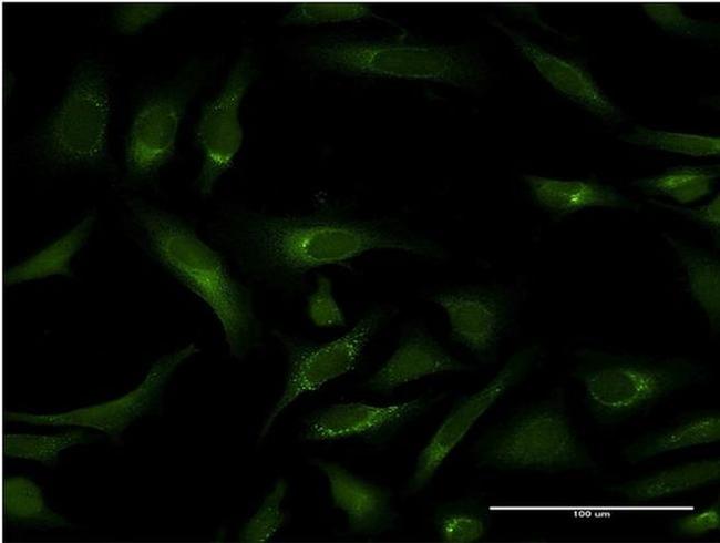 PIPOX Antibody in Immunocytochemistry (ICC/IF)