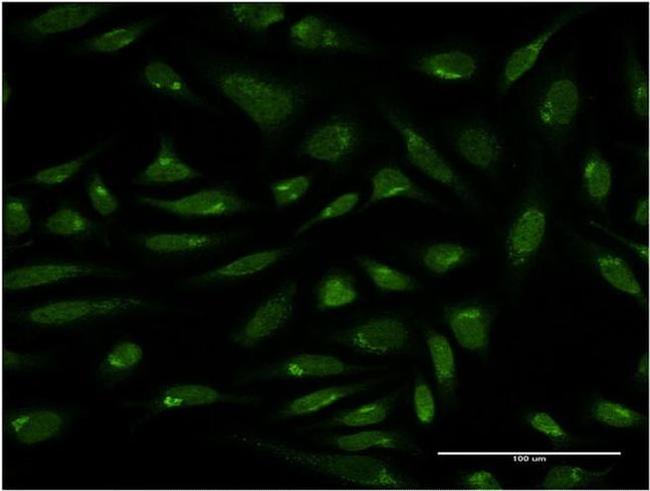 PIH1D1 Antibody in Immunocytochemistry (ICC/IF)