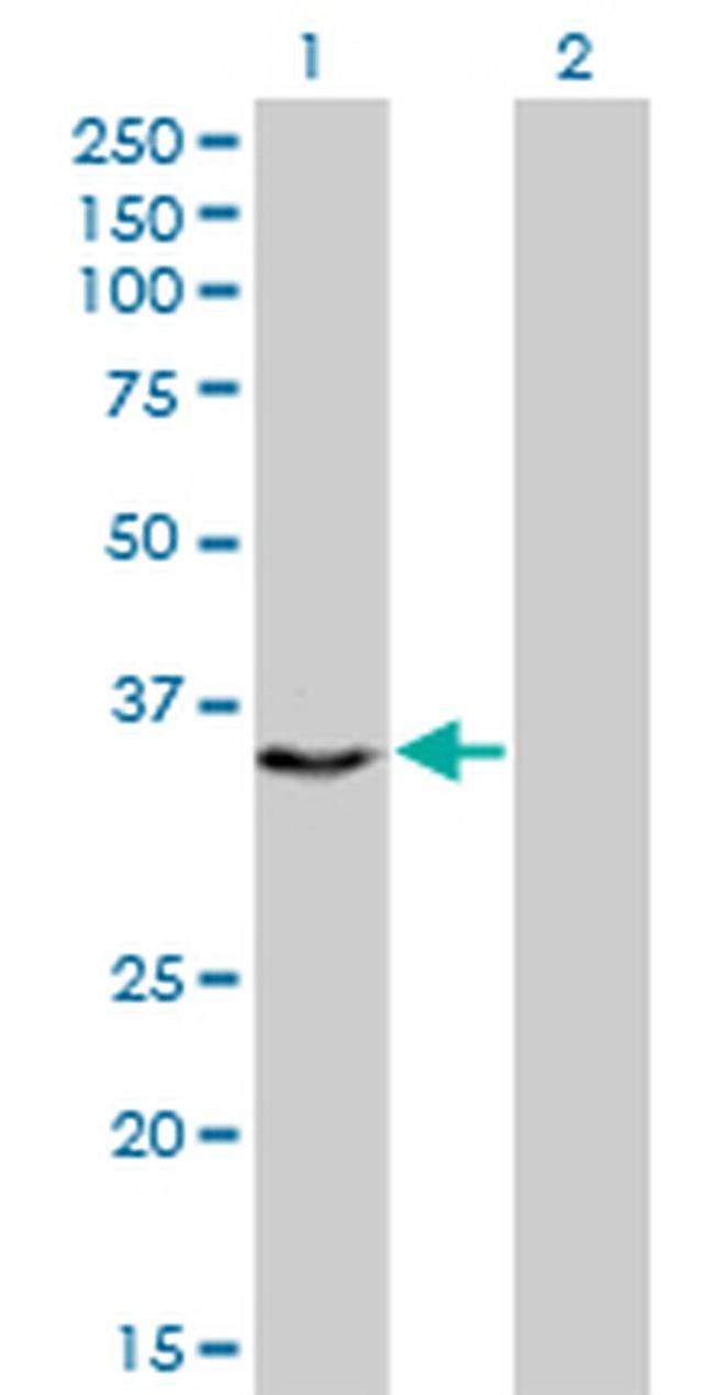 CENPH Antibody in Western Blot (WB)